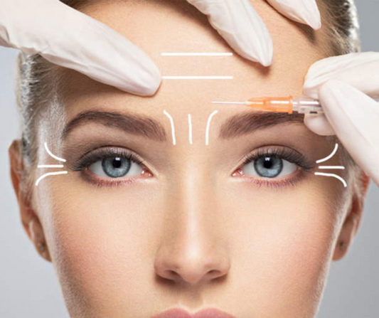 Aplicación de Botox