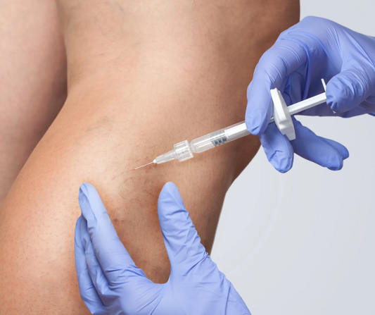 ESCLEROTERAPIA PARA VARICES
